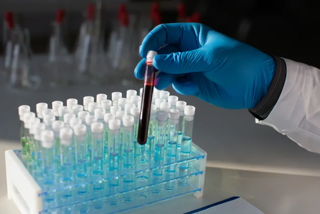 Tempus to buy cancer test-maker Personalis for $1.5B